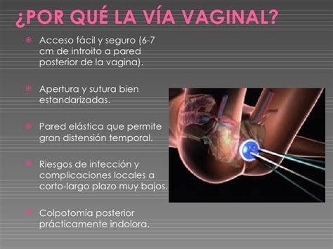 Como Entra El Pene En La Vagina